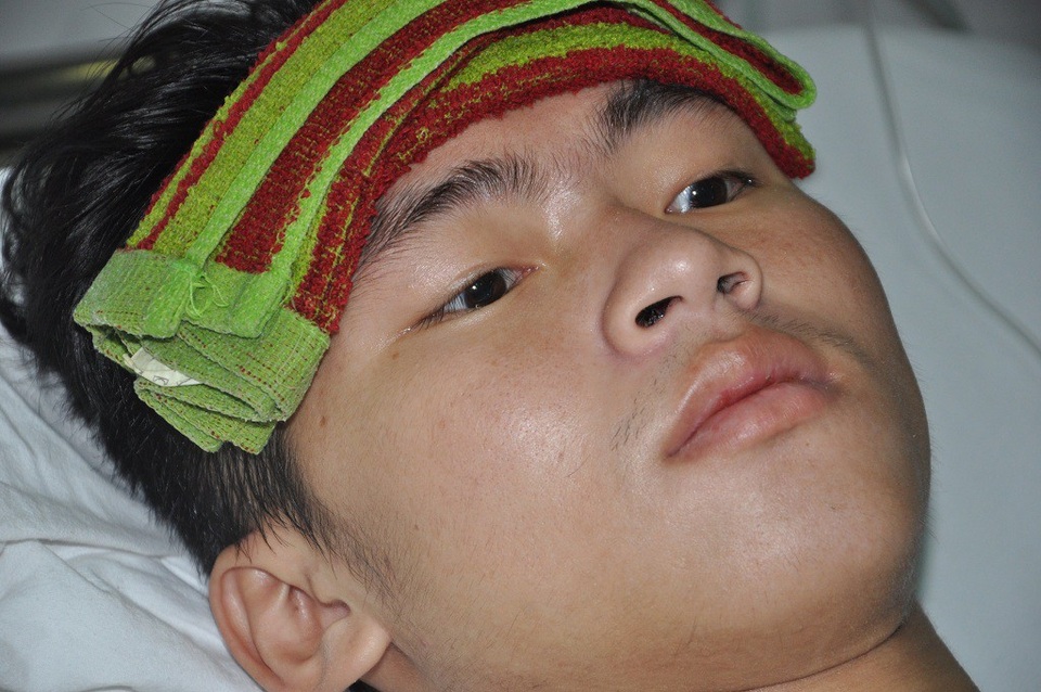 Chàng trai tuổi 20 xin mẹ "đừng bắt con phải chết" vì thiếu 50 triệu đồng - 1 Bị tim bẩm sinh có chỉ định phải phẫu thuật nhưng hiện Phương đang bị nhiễm trùng nặng nên đang phải điều trị kháng sinh liều cao.