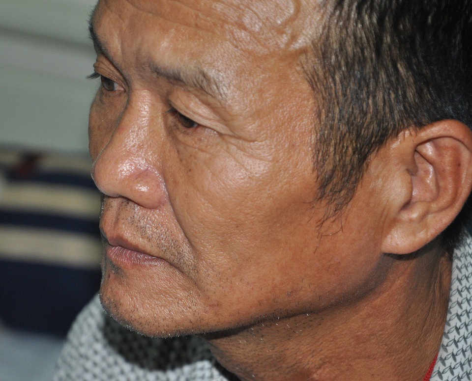 Bố anh Kiên đau đớn khi cả 3 con đều mang bệnh.