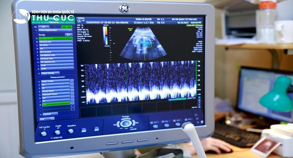 Lạm dụng sóng siêu âm có thể gây dị tật cho thai nhi