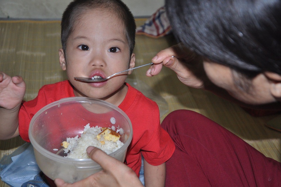 Không vay nổi 20 triệu đồng, tính mạng bé 3 tuổi nguy kịch vì bệnh tim - 1 Bé Quyền ăn cơm với mấy miếng trứng rán được mẹ mang đi từ sáng.