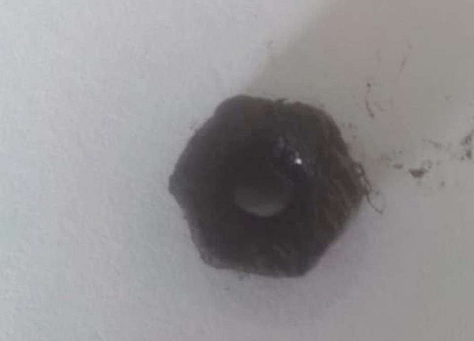 Con ốc được các bác sĩ gắp ra từ mũi cháu bé.