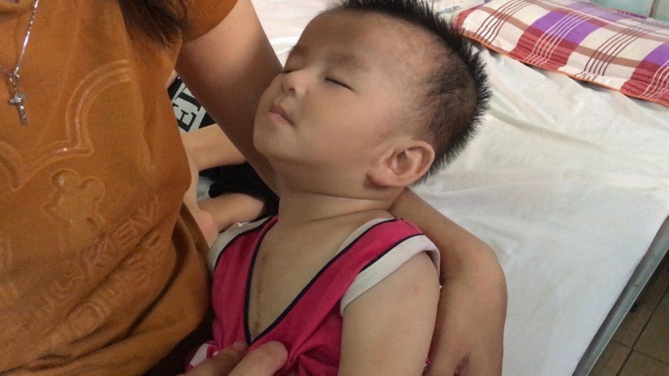 Cuộc sống cùng cực của vợ chồng nghèo có hai con bị bại não, tim bẩm sinh - 7
Hai cháu giờ chỉ có thể điều trị theo liệu trình và lâu dài. Về bệnh tim của cháu Thành, các bác sĩ cho biết , cháu bị rất nặng và chưa thể nói trước được điều gì. Cần phải tiếp tục đưa lên tuyến trên để phẫu thuật và theo dõi .