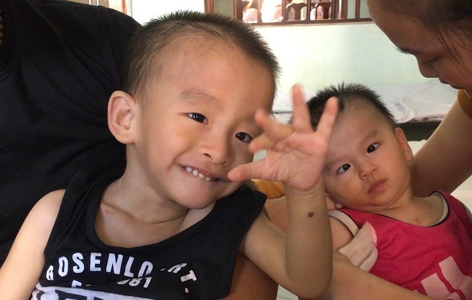 Cuộc sống cùng cực của vợ chồng nghèo có hai con bị bại não, tim bẩm sinh - 2 Hai đứa trẻ đáng thương Hải Đăng và Tiến Thành