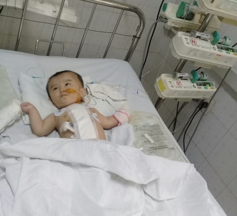 Cuộc sống cùng cực của vợ chồng nghèo có hai con bị bại não, tim bẩm sinh - 5 Chứng tim bẩm sinh của cháu Thành thuộc diện Fallot 4 (bị 4 khiếm khuyết trong tim). Cháu đã phẫu thuật một lần, nhưng do quá nặng nên sẽ tiếp tục phải phẫu thuật thêm lần nữa và cũng chưa biết liệu có thành công hay không