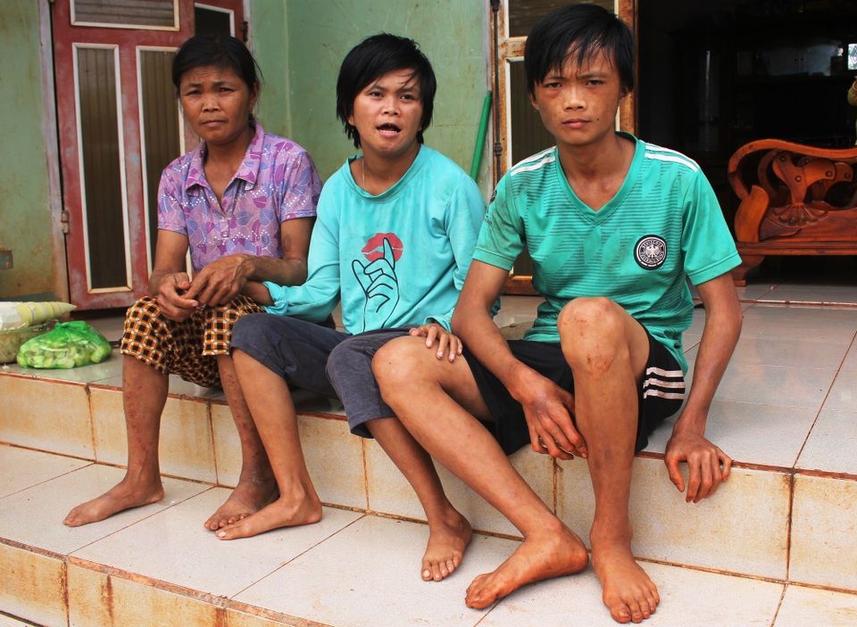 Mẹ bị suy thận giai đoạn cuối “gồng mình” nuôi 2 con tật nguyền - 1 Người mẹ bị suy thận mãn tính giai đoạn cuối, 2 người con bị teo chân tay, trong đó có cháu bị bệnh đao