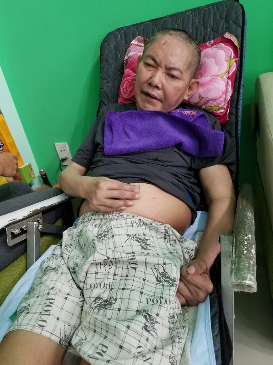 Vụ bệnh nhân bị bẻ gãy tay: Nghi vấn công ty khám chữa bệnh chui? - 1 Nửa người bên trái của ông Hàm bị liệt nhưng bà Hương cho rằng ông phản xạ giật mạnh nên gãy tay