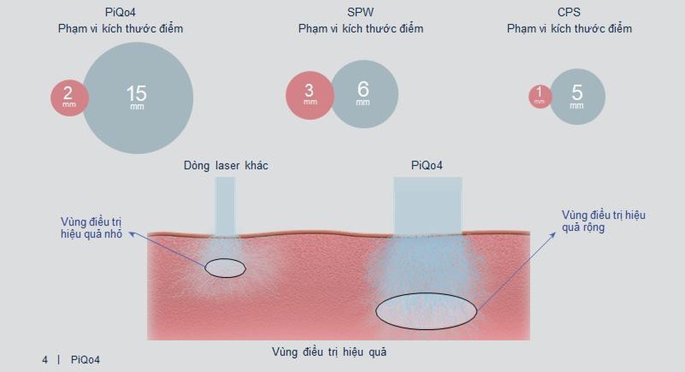 Lần đầu tiên xuất hiện tại Việt Nam, PiQo4 Lumenis đốn tim hàng triệu tín đồ làm đẹp - 3 So sánh kích thước điểm của PiQo4 và một số dòng máy tương tự.