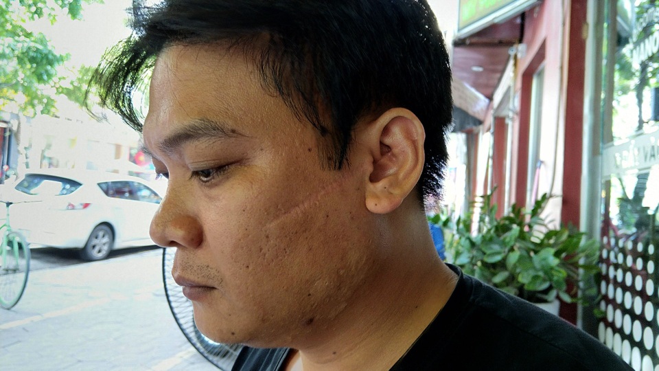 Phục hồi điều tra vụ chủ cầm đồ chém khách, lấy xe máy - 1 Anh Đức bị thương tích 15%, anh Đức cũng kiến nghị cơ quan công an phải khởi tố nhóm đối tượng thêm tội danh