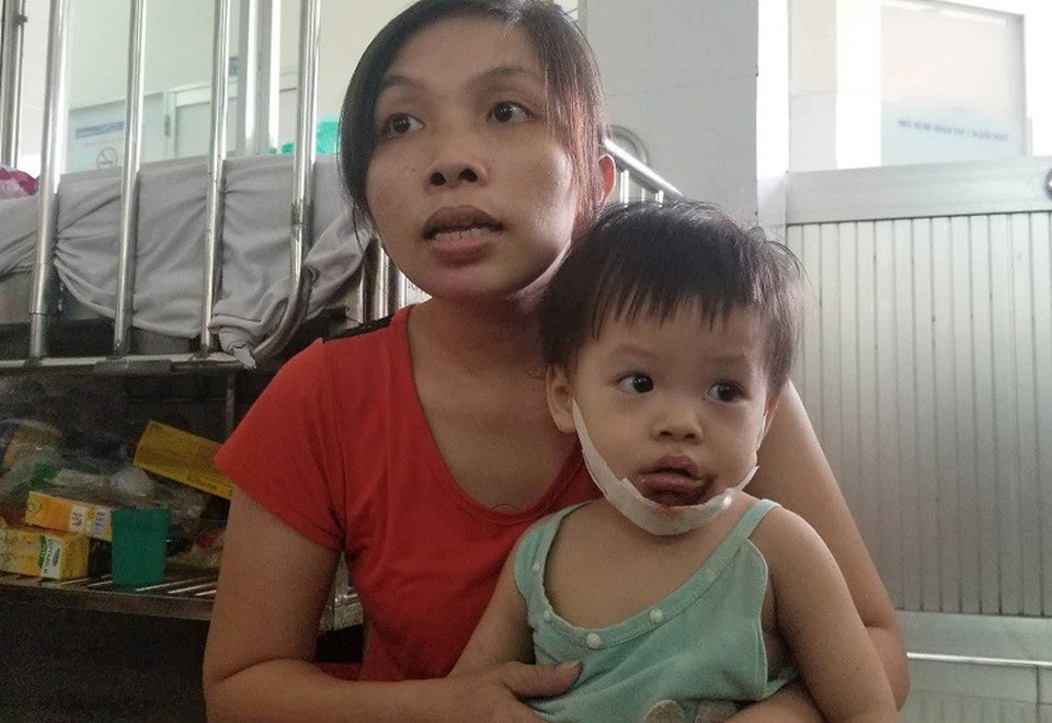 Vụ bé gái bị bỏng miệng: Gia đình trông trẻ nhận trách nhiệm - 4 Mẹ con chị Lài tại khoa Bỏng, Bệnh viện Nhi đồng 1