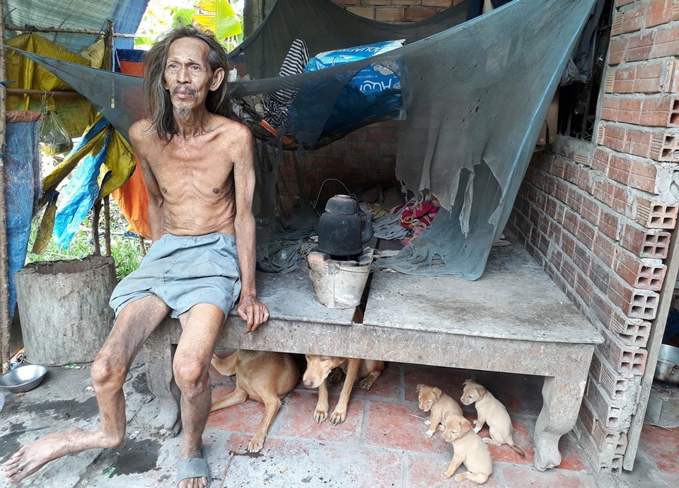 "Nhà tôi không khác trại tâm thần, ngày nào tôi cũng bị chúng nó đánh" - 2
Anh Cao Thành (52 tuổi) bị tật ở chân và bị tâm thần nhẹ