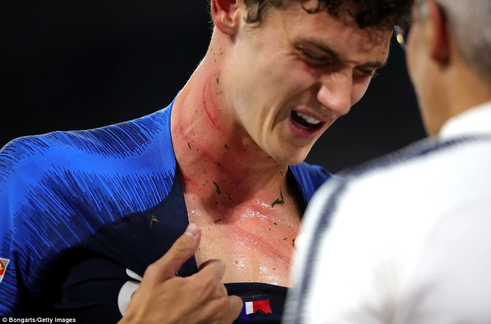 Đức 0-0 Pháp: Bất phân thắng bại - 4
Griezmann đầy đau đớn sau khi bị Rudiger cào