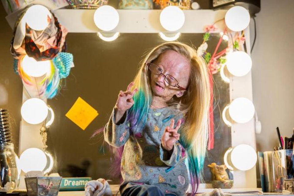 Mắc hội chứng lão hóa hiếm gặp, bé 11 tuổi vẫn trở thành ngôi sao mạng - 1 Hiện tại, Adalia đang có 1,5 triệu người theo dõi trên Youtube