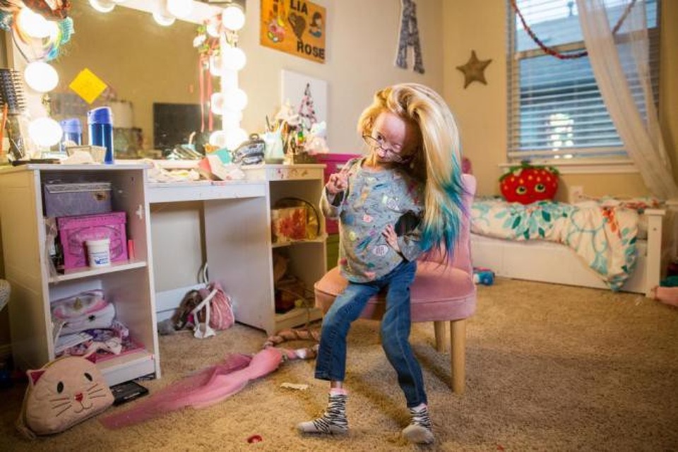 Mắc hội chứng lão hóa hiếm gặp, bé 11 tuổi vẫn trở thành ngôi sao mạng - 2 Dù mắc bệnh lạ nhưng cô bé luôn vui vẻ và hạnh phúc