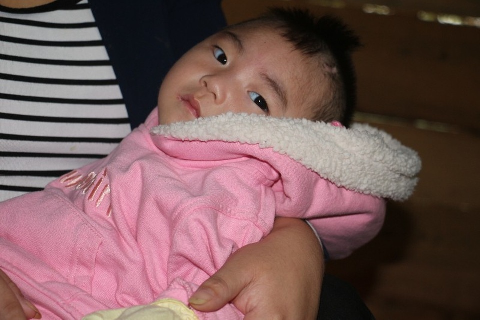 Thương bé 1 tuổi mang bệnh não úng thủy - 7 Đôi vợ chồng trẻ dường như đã kiệt quệ, bất lực, nhưng trong ánh mắt trong veo của cháu bé đầy ám ánh như muốn van xin hãy cứu giúp