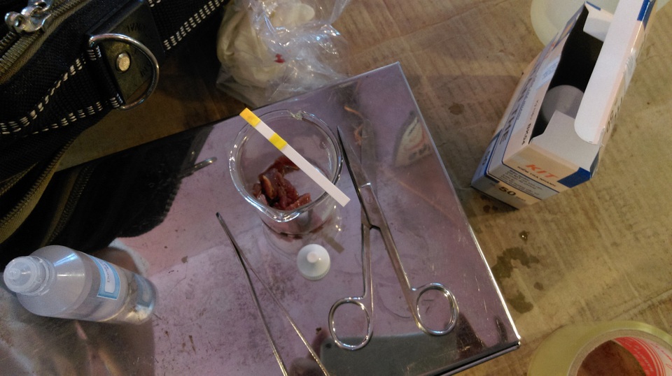 Kết quả thử nhanh dương tính với hàn the