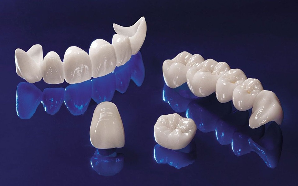 7 sự thật ít biết về "dịch vụ thẩm mỹ răng sứ" - 1 Răng sứ Herazi, Emax, Demax, Ceramill là những loại tốt bạn có thể lựa chọn