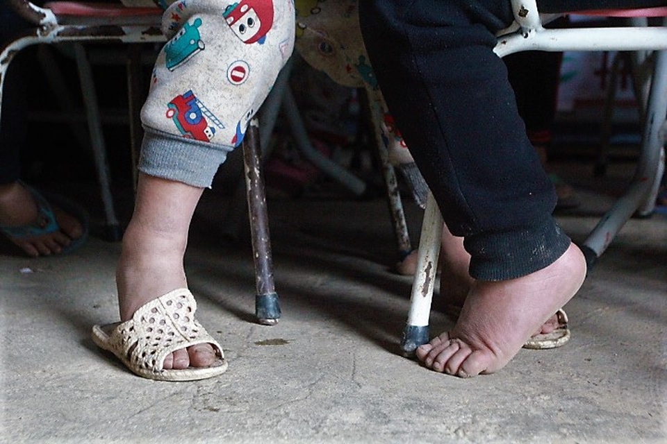 "Chuyện tình" mặn chát của cô giáo ở đèo Khau Phạ - 3 
Chân của Nhà bị đỏ và sưng phù lên vì rét