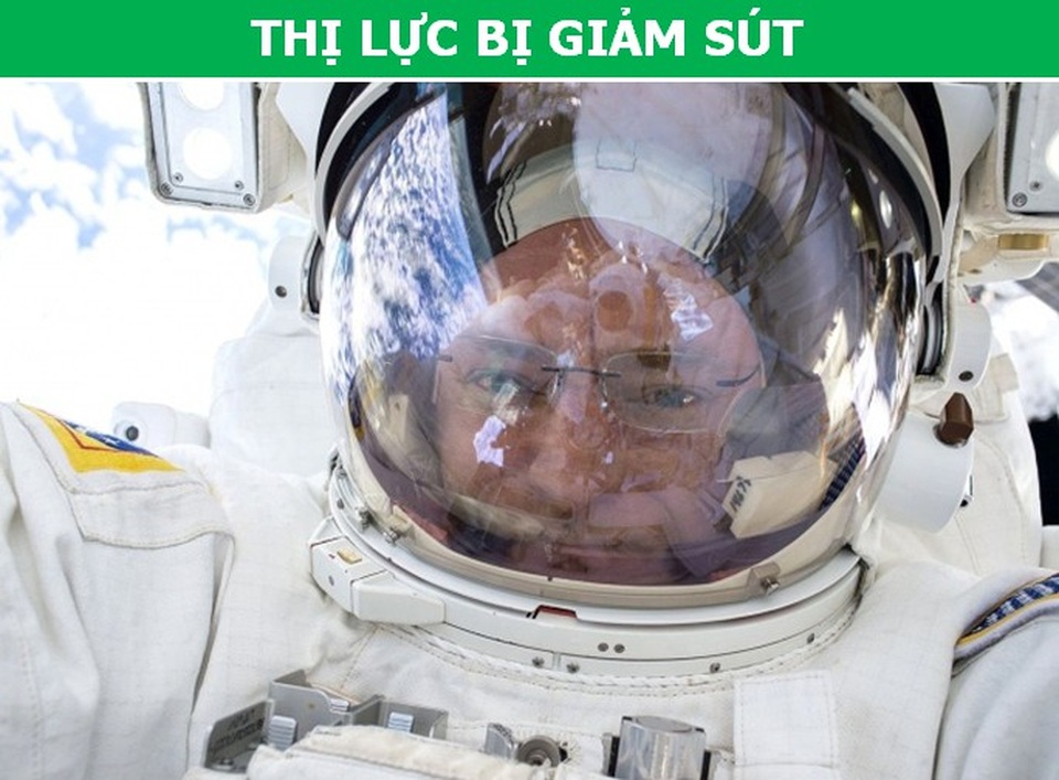 Các phi hành gia sẽ bị ảnh hưởng thế nào trong môi trường không trọng lực - 1