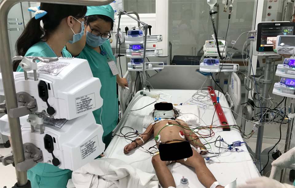 Ngã vào mảnh sành, bé gái 30 tháng tuổi bị đứt động mạch cổ - 1 Sau phẫu thuật, bệnh nhi đang được hồi sức tích cực