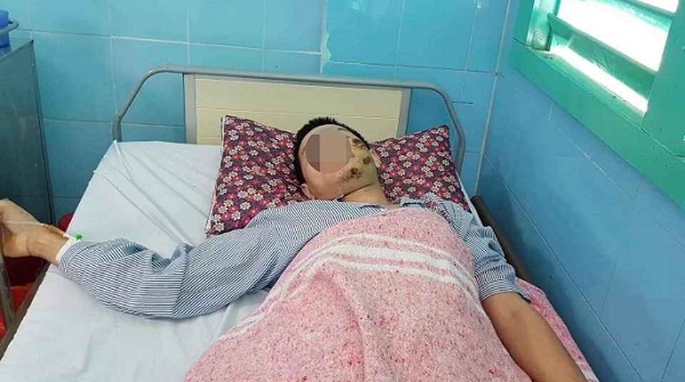 Đau quặn vùng hông sau ngã vài tiếng, bác sĩ xác định do vỡ thận - 1 Đau quặn vùng hông sau ngã vài tiếng, bác sĩ xác định do vỡ thận - 1