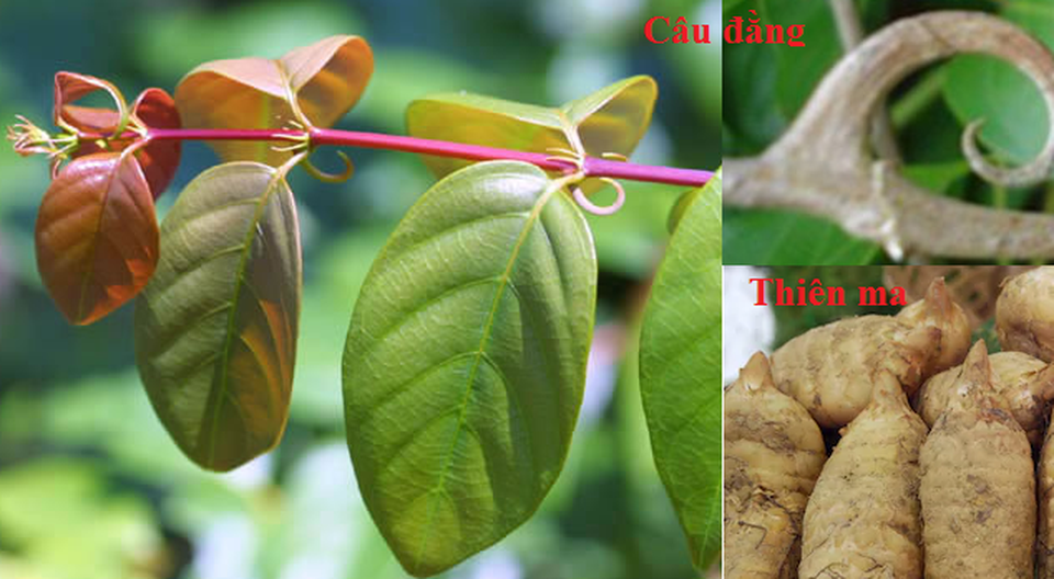 Run tay không phải lúc nào cũng là Parkinson, nhưng chớ coi nhẹ! - 3 Run tay không phải lúc nào cũng là Parkinson, nhưng chớ coi nhẹ! - 3