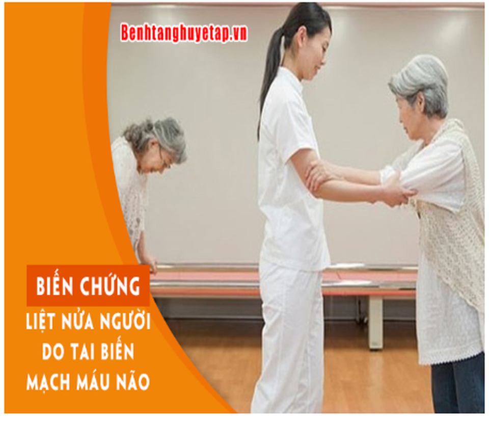 5 di chứng tai biến mạch máu não thường gặp nhất - 1 5 di chứng tai biến mạch máu não thường gặp nhất - 1