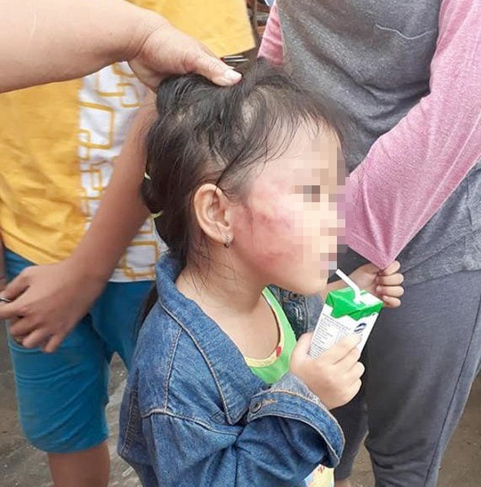 Những vụ bạo hành trẻ mầm non xôn xao dư luận năm 2018 - 2