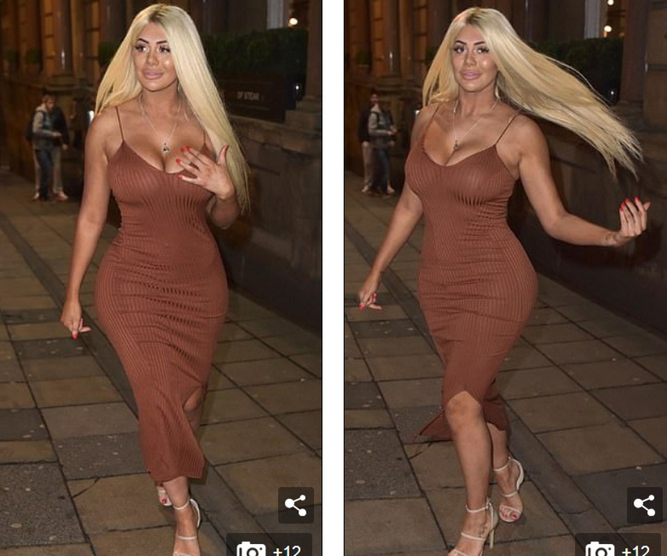 Chloe Ferry lại khoe thân hình dao kéo - 2