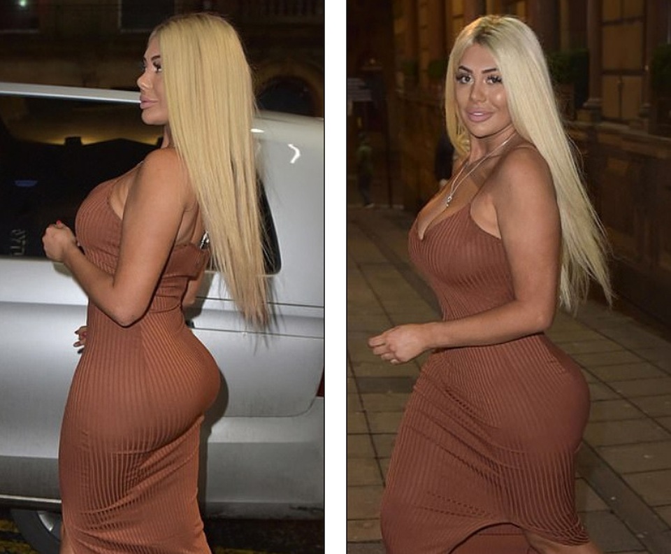 Chloe Ferry lại khoe thân hình dao kéo - 6