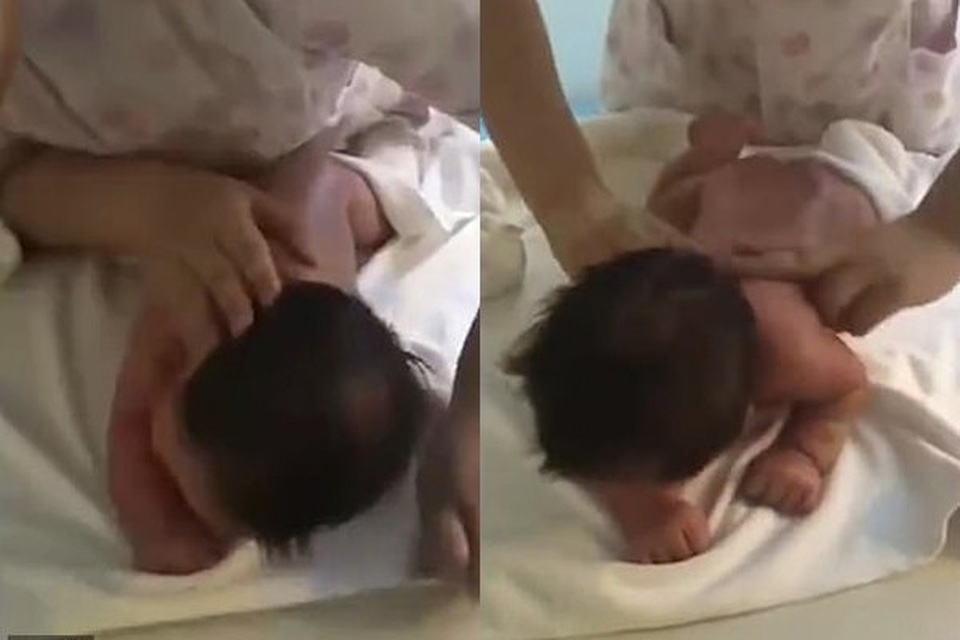 Mẹ sững người nghe âm thành phát ra từ miệng con trai 23 ngày tuổi giữa lúc y tá đang xoa lưng bé - 1 Mẹ sững người nghe âm thành phát ra từ miệng con trai 23 ngày tuổi giữa lúc y tá đang xoa lưng bé - 1