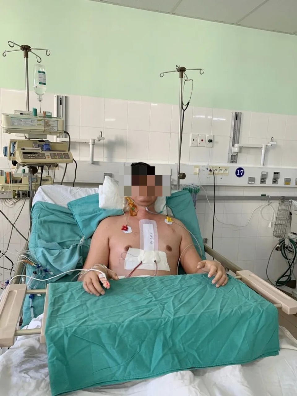 Thêm một ca ghép tim xuyên quốc gia thành công - 5 Thêm một ca ghép tim xuyên quốc gia thành công - 5