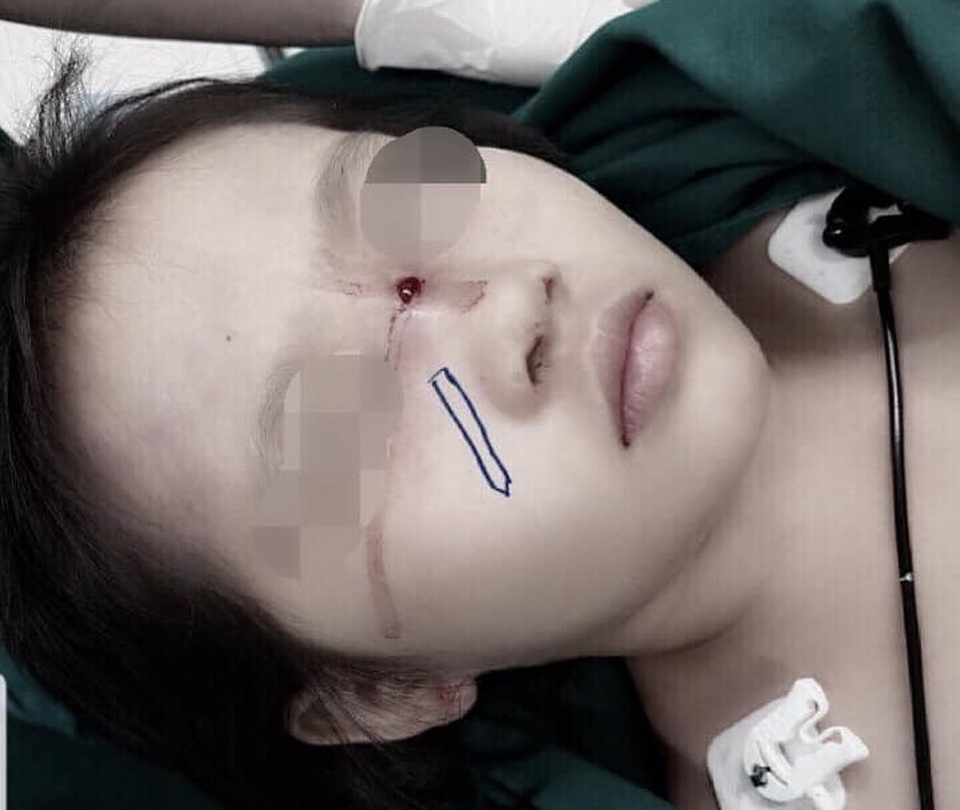 Chưa kịp đón Tết, nhiều trẻ đã gặp tai nạn thương tâm - 2