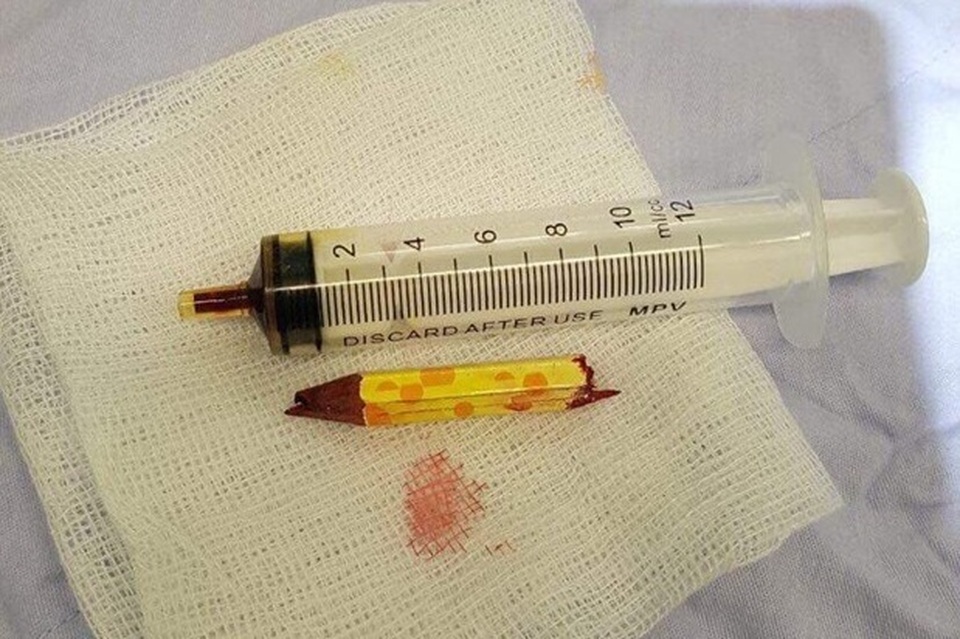 Chưa kịp đón Tết, nhiều trẻ đã gặp tai nạn thương tâm - 1