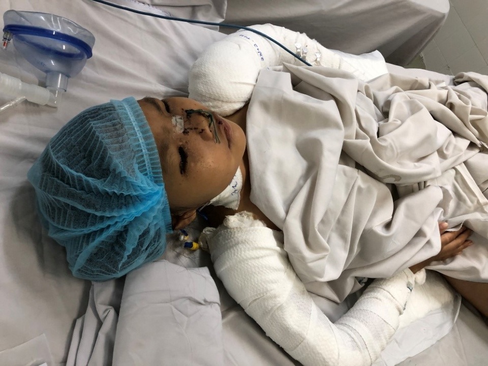 Chưa kịp đón Tết, nhiều trẻ đã gặp tai nạn thương tâm - 4