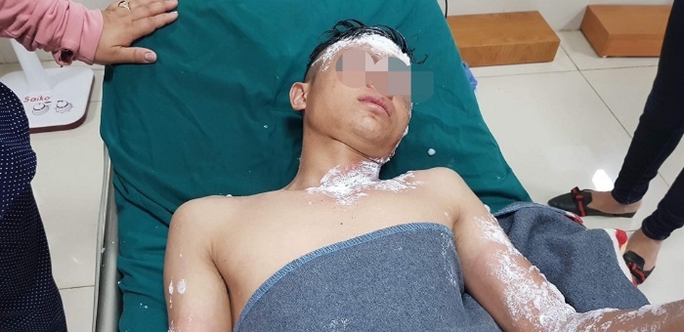 Nổ pháo, hàng loạt trường hợp nhập viện cấp cứu trong đêm giao thừa - 2 Nổ pháo, hàng loạt trường hợp nhập viện cấp cứu trong đêm giao thừa - 2