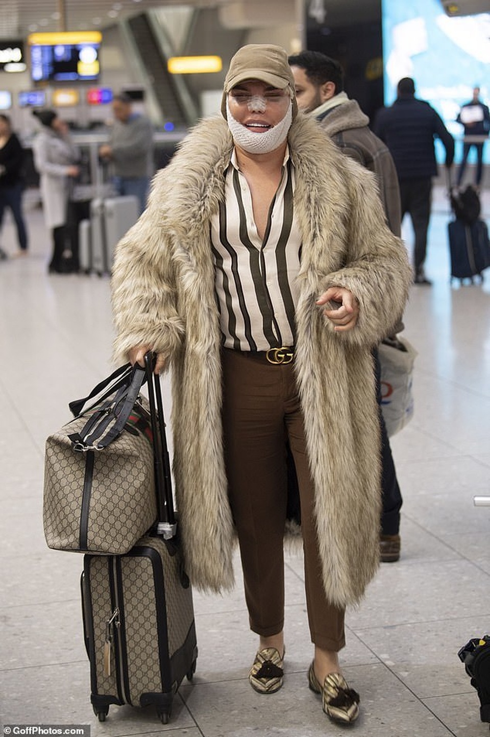 Búp bê Ken Rodrigo Alves lộ mặt sưng phồng sau ca dao kéo - 1 Búp bê Ken Rodrigo Alves lộ mặt sưng phồng sau ca dao kéo - 1