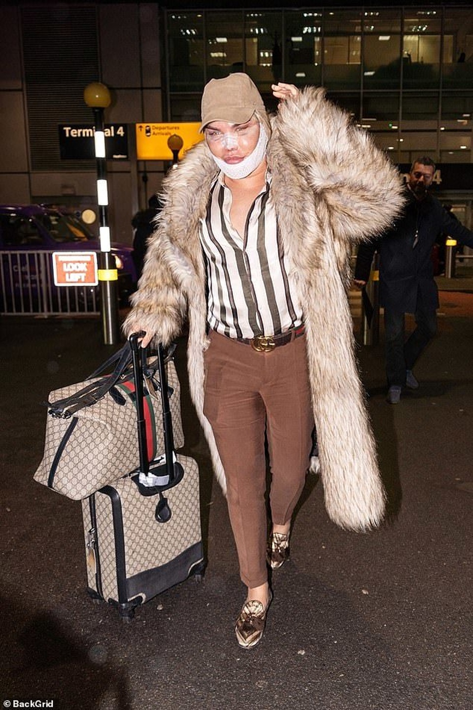 Búp bê Ken Rodrigo Alves lộ mặt sưng phồng sau ca dao kéo - 4 Búp bê Ken Rodrigo Alves lộ mặt sưng phồng sau ca dao kéo - 4