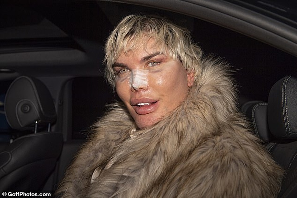 Búp bê Ken Rodrigo Alves lộ mặt sưng phồng sau ca dao kéo - 5 Búp bê Ken Rodrigo Alves lộ mặt sưng phồng sau ca dao kéo - 5