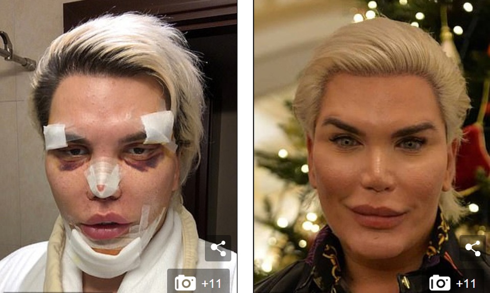 Búp bê Ken Rodrigo Alves lộ mặt sưng phồng sau ca dao kéo - 6 Búp bê Ken Rodrigo Alves lộ mặt sưng phồng sau ca dao kéo - 6