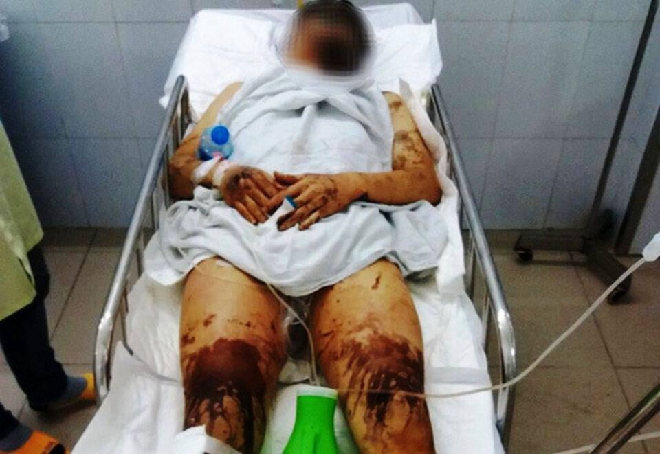 Truy lùng hung thủ cắt gân chân, tạt axit đôi nam nữ giữa Tết - 1 Truy lùng hung thủ cắt gân chân, tạt axit đôi nam nữ giữa Tết - 1
