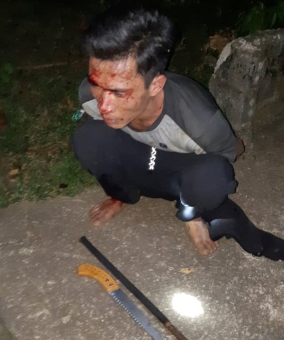 Nhiều cán bộ, chiến sĩ nguy cơ phơi nhiễm HIV khi bắt kẻ trộm cây sưa - 1