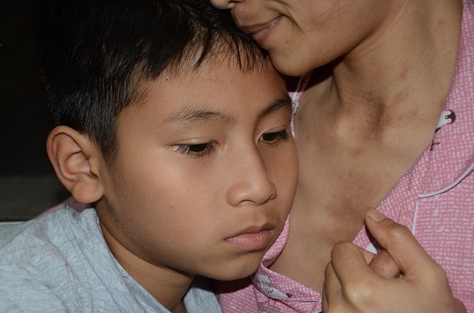 Đớn đau mẹ đơn thân nguy kịch vì bệnh ung thư phổi - 5 Đớn đau mẹ đơn thân nguy kịch vì bệnh ung thư phổi - 5