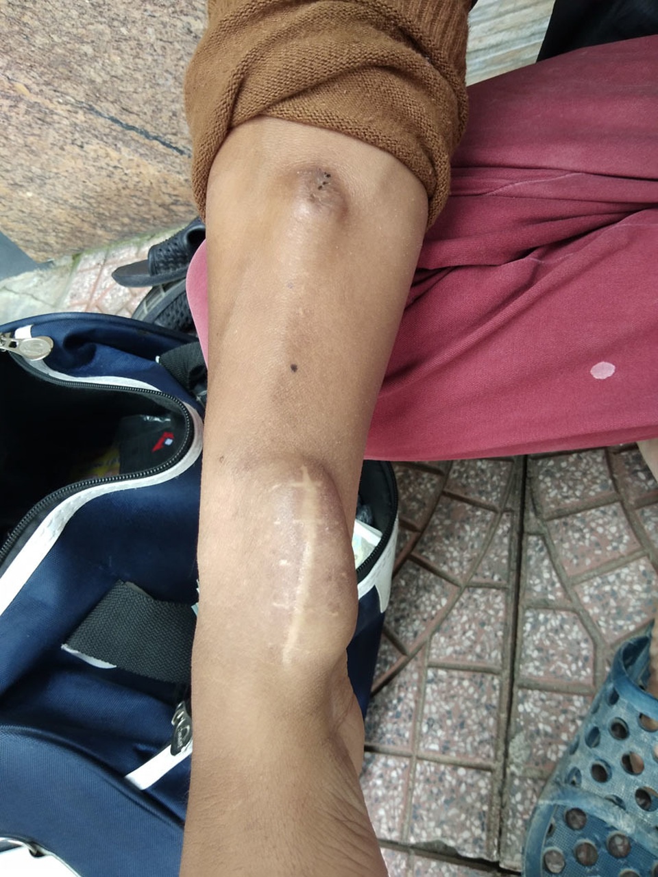Cảm phục nghị lực của chàng trai 10 năm ròng đánh giày lấy tiền chạy thận - 3 Cảm phục nghị lực của chàng trai 10 năm ròng đánh giày lấy tiền chạy thận - 3