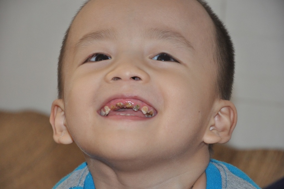Nghẹn ngào cảnh mẹ đơn thân mong cứu con khỏi bệnh bại não - 3 Nghẹn ngào cảnh mẹ đơn thân mong cứu con khỏi bệnh bại não - 3