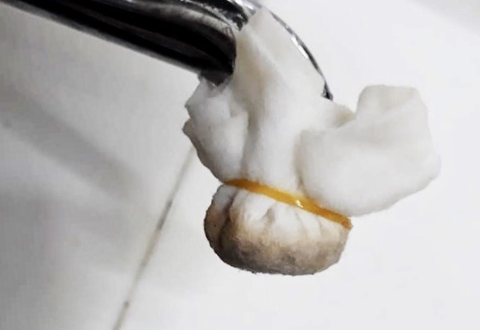 Đà Nẵng: Dân kêu trời vì nước sạch vàng đục, lắng cặn đen sì - 1 Đà Nẵng: Dân kêu trời vì nước sạch vàng đục, lắng cặn đen sì - 1