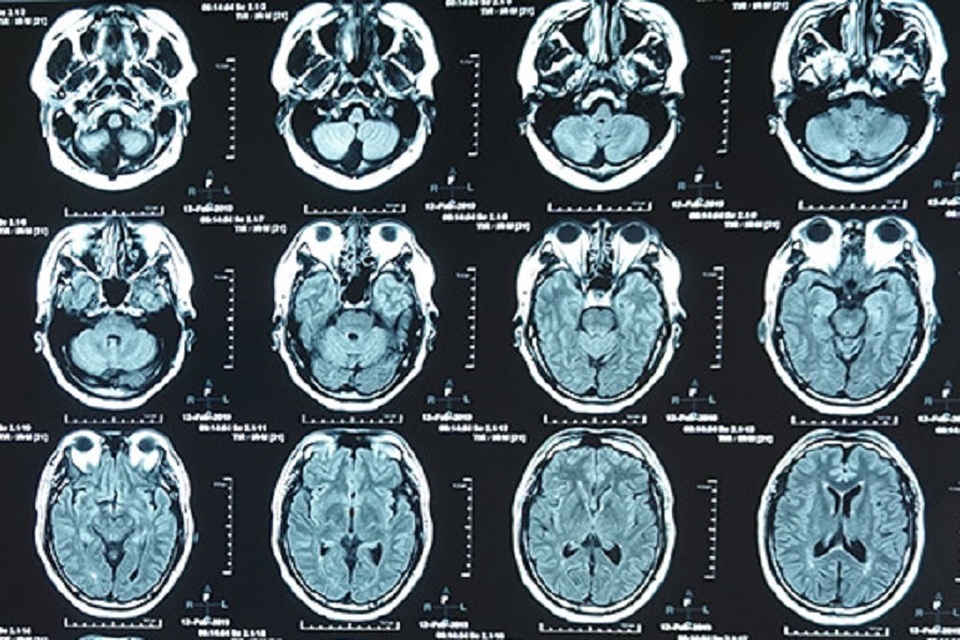 MRI truoc.jpg MRI truoc.jpg