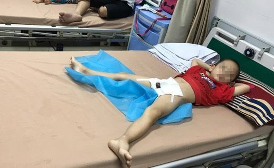 Thêm 29 bé trai Hưng Yên bị sùi mào gà do nong bao quy đầu tại nhà nữ y sĩ - 2..jpg Thêm 29 bé trai Hưng Yên bị sùi mào gà do nong bao quy đầu tại nhà nữ y sĩ - 2..jpg