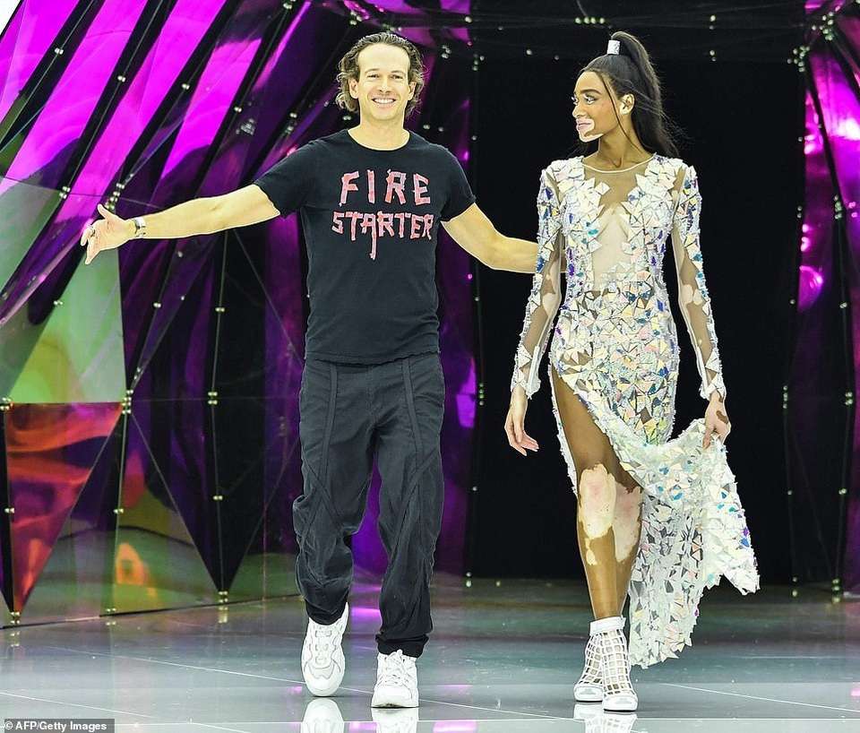 Siêu mẫu bạch biến nổi bật tại tuần lễ thời trang Milan - 4 Siêu mẫu bạch biến nổi bật tại tuần lễ thời trang Milan - 4