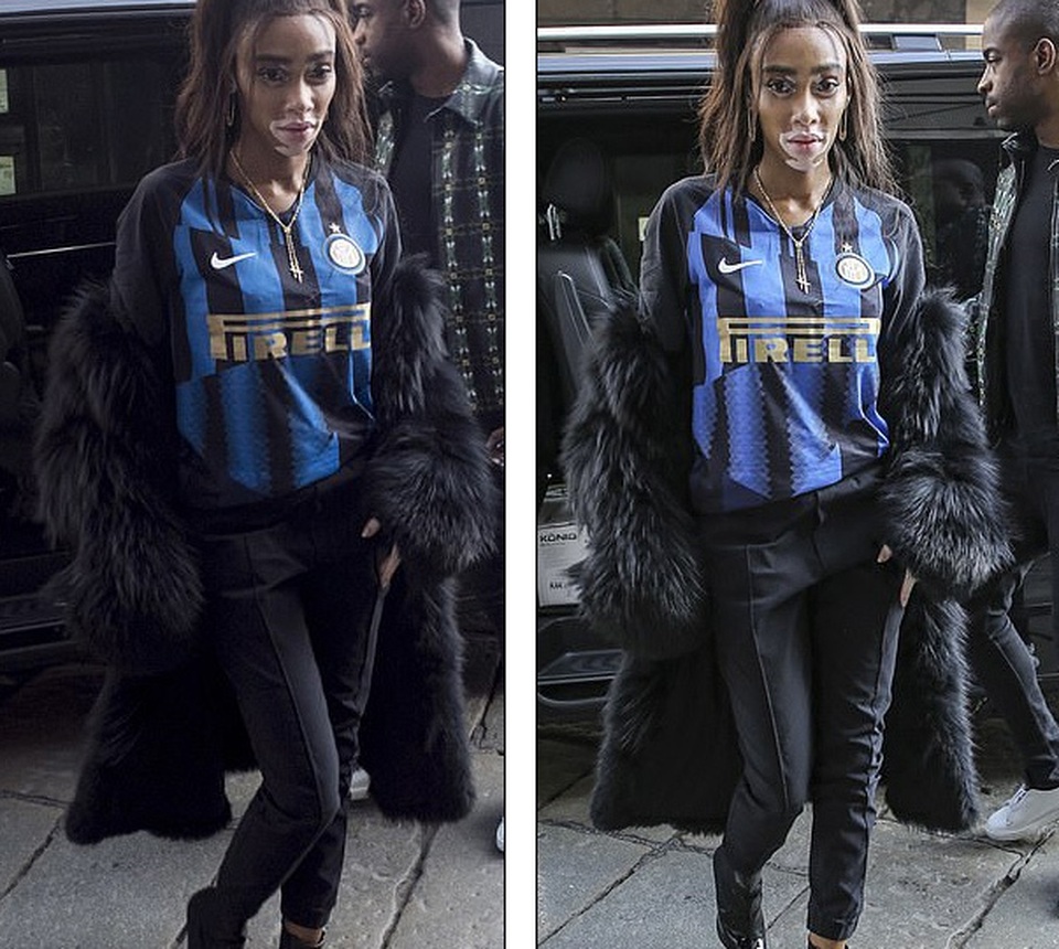 Siêu mẫu bạch biến nổi bật tại tuần lễ thời trang Milan - 9 Siêu mẫu bạch biến nổi bật tại tuần lễ thời trang Milan - 9