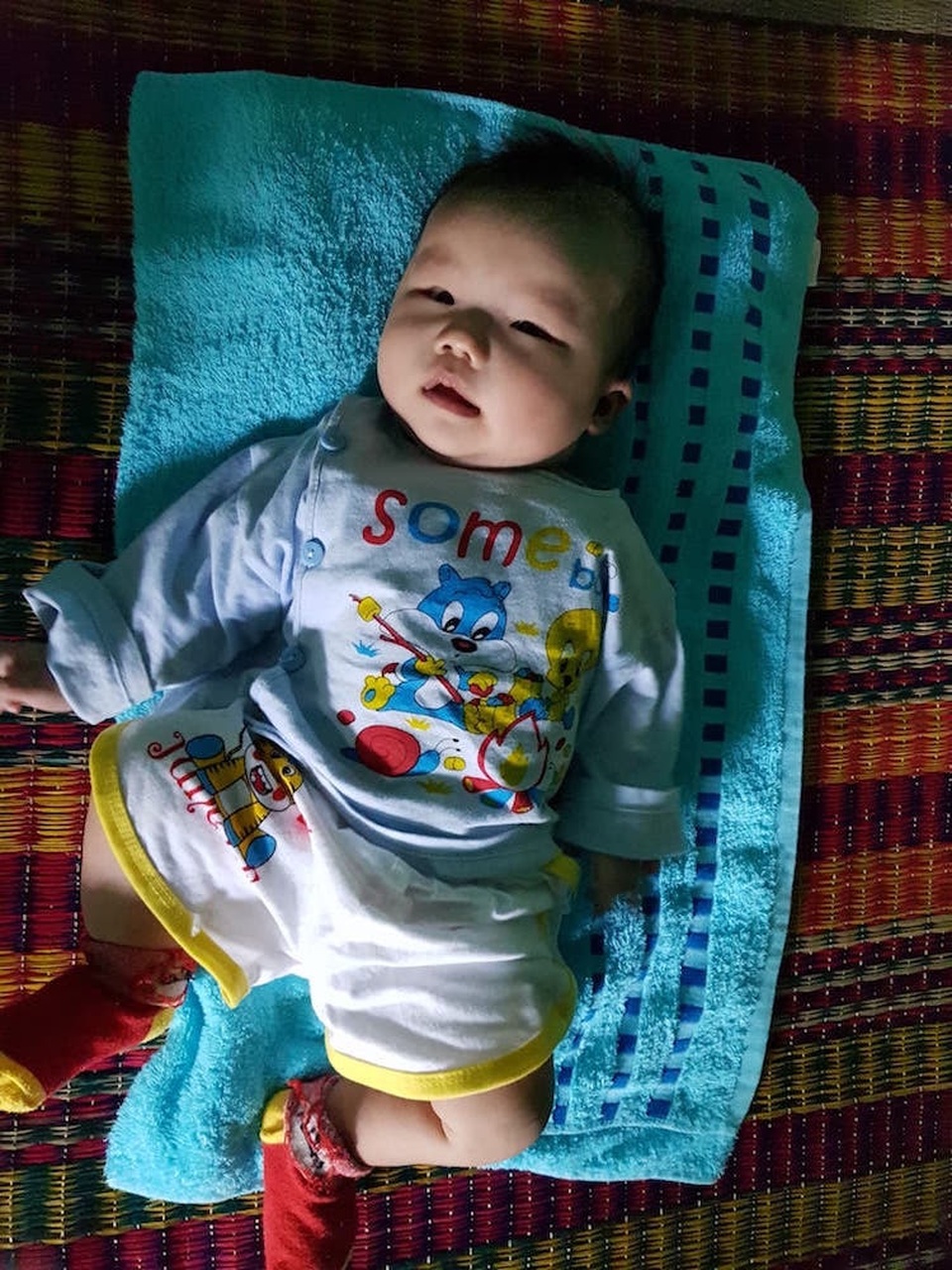 Dị tật không lá lách, tim bẩm sinh, bé trai 4 tháng nguy kịch - 2 Dị tật không lá lách, tim bẩm sinh, bé trai 4 tháng nguy kịch - 2
